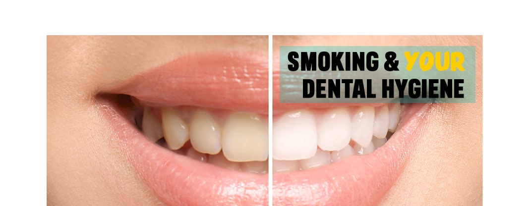 How does Going Smokefree Help Your Dental Hygiene? - One You Surrey